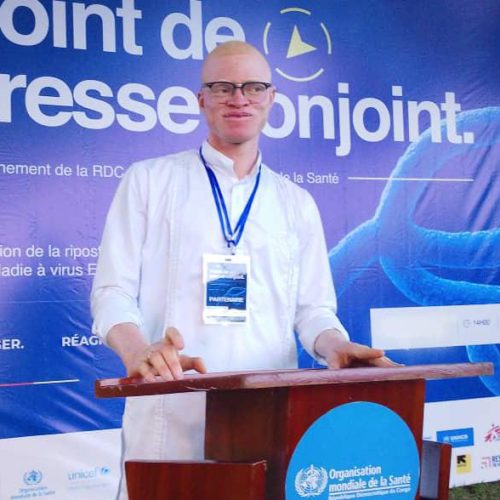 Journée internationale de l&rsquo;albinisme : « Les préjugés reculent, mais le combat continue », affirme l&rsquo;OBEAC Ituri